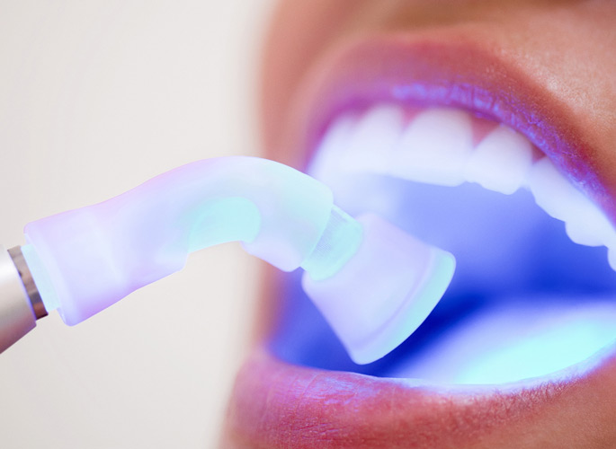 blue rays in teeth